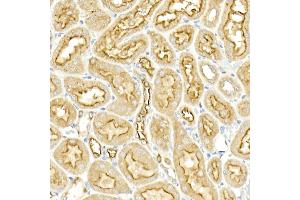 Immunohistochemistry of paraffin-embedded rat kidney using SLC12 Rabbit pAb (ABIN6131136, ABIN6147843, ABIN6147844 and ABIN6215366) at dilution of 1:50 (40x lens). (SLC12A2 Antikörper  (AA 120-280))