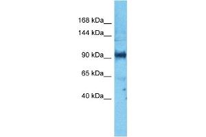 Host:  Rabbit  Target Name:  PARD3  Sample Type:  PANC1 Whole Cell lysates  Antibody Dilution:  1. (PARD3 Antikörper  (N-Term))