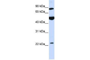 WB Suggested Anti-GCS1 Antibody Titration:  0. (GCS1 Antikörper  (N-Term))