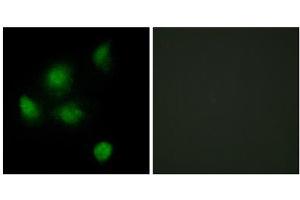 Immunofluorescence analysis of HeLa cells, using SIN3B antibody. (SIN3B Antikörper  (Internal Region))