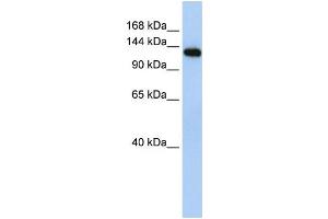 Western Blotting (WB) image for anti-Myosin Binding Protein C, Fast Type (MYBPC2) antibody (ABIN2458630)