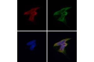 ABIN6257207 and ABIN6275954 staining Hela by IF/ICC.