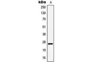 Western Blotting (WB) image for anti-Potassium Large Conductance Calcium-Activated Channel, Subfamily M, beta Member 2 (KCNMB2) (Center) antibody (ABIN7297744)