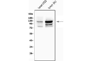 Western blot analysis of NFAT2/NFATC1 using anti-NFAT2/NFATC1 antibody (ABIN7601529).