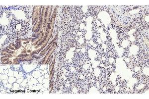 Immunohistochemical analysis of paraffin-embedded rat lung tissue. (PERK Antikörper  (pThr981))