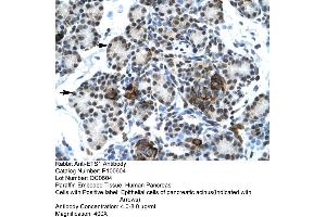 Human Pancrease (ETS1 Antikörper  (N-Term))