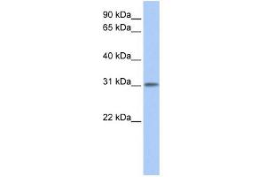 WB Suggested Anti-ODF3L1 Antibody Titration: 0.