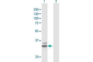 Western Blot analysis of PPT1 expression in transfected 293T cell line by PPT1 MaxPab polyclonal antibody. (PPT1 Antikörper  (AA 1-306))