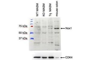 AP31401PU-N NOX1 antibody staining of MASM lysate at 1 µg/ml (35 µg protein in RIPA buffer). (NOX1 Antikörper  (Internal Region))
