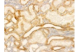 ABIN6265674 and ABIN6266664 at 1/100 staining human normal kidney tissue by IHC-P. (TOP2B Antikörper  (N-Term))