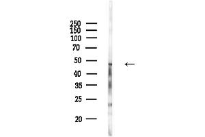 Western blot analysis of lysates from COLO205 cells(heat-shock,45 min treatment), using NFATc2IP Antibody at 1/1000 dilution.
