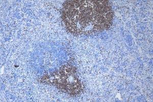 IHC analysis of CD3 epsilon/Cd3e using anti-CD3 epsilon/Cd3e antibody (ABIN7600665). (CD3 epsilon Antikörper  (AA 22-113))