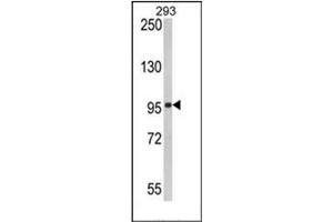Image no. 1 for anti-DEAD (Asp-Glu-Ala-Asp) Box Polypeptide 58 (DDX58) (AA 592-622) antibody (ABIN357195)
