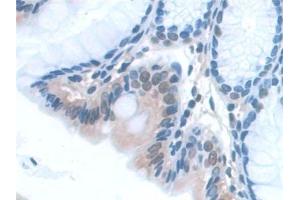 Detection of SNAP23 in Mouse Colon Tissue using Polyclonal Antibody to Synaptosomal Associated Protein 23 kDa (SNAP23)