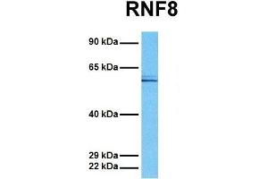 Host:  Rabbit  Target Name:  RNF8  Sample Tissue:  Human MCF7  Antibody Dilution:  1. (RNF8 Antikörper  (C-Term))