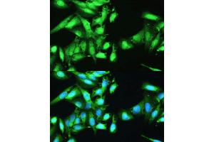 Immunofluorescence analysis of U2OS cells using STAT1 antibody. (STAT1 Antikörper  (AA 650-750))