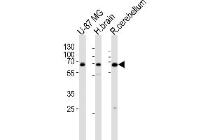 Western Blotting (WB) image for anti-Calcium/calmodulin-Dependent Protein Kinase Kinase 2, beta (CAMKK2) (AA 43-71), (N-Term) antibody (ABIN5533844)