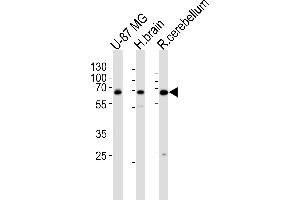Western blot analysis of lysates from U-87 MG cell line , human brain and rat cerebellum tissue lysate(from left to right), using Mouse Camkk2 Antibody at 1:1000 at each lane. (CAMKK2 Antikörper  (N-Term))