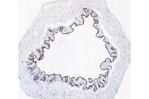 IHC analysis of Cytokeratin 20/Krt20 using anti-Cytokeratin 20/Krt20 antibody (ABIN7601133). (KRT20 Antikörper  (AA 29-431))