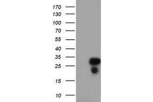 Western Blotting (WB) image for anti-Regulator of G-Protein Signaling 16 (RGS16) antibody (ABIN1500691) (RGS16 Antikörper)