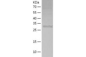 MRPS2 Protein (AA 1-296) (His tag)