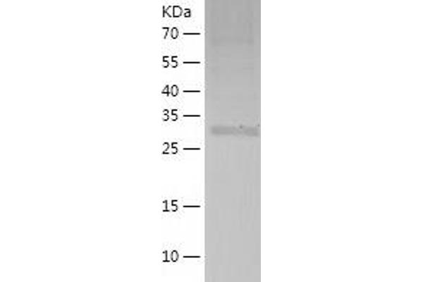 MRPS2 Protein (AA 1-296) (His tag)