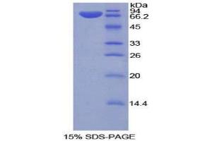 SDS-PAGE (SDS) image for Klotho (KL) (AA 517-956) protein (His tag) (ABIN1877943)