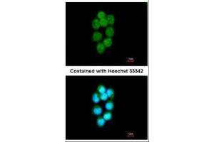 ICC/IF Image Immunofluorescence analysis of methanol-fixed A431, using TDP1, antibody at 1:200 dilution.