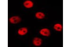Immunofluorescence (fixed cells) (IF/ICC) image for anti-Histone H3.1 (HIST1H3B) (pSer10) antibody (ABIN6254919)