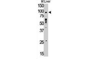 Western blot analysis of TLR6 polyclonal antibody  in mouse liver tissue lysate (35 ug/lane). (TLR6 Antikörper  (C-Term))