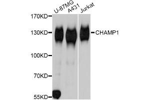 Western blot analysis of extracts of various cell lines, using CHAMP1 Antibody. (ZNF828 Antikörper)