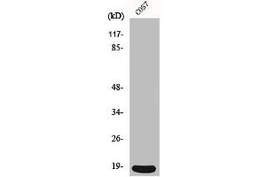 Western Blot analysis of COS7 cells using p18 Polyclonal Antibody (CDKN2C Antikörper  (C-Term))
