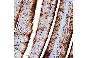 IHC analysis of RAB7/RAB7A using anti-RAB7/RAB7A antibody (ABIN7600597).