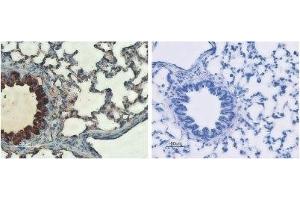 Expression of CFTR in rat lungs - Immunohistochemical staining of rat lungs sections using Anti-CFTR Antibody (ABIN7043096, ABIN7044127 and ABIN7044128) (left panel). (CFTR Antikörper  (C-Term, Cytosolic))
