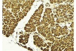 ABIN6269087 at 1/100 staining Mouse pancreas tissue by IHC-P. (HSP27 Antikörper  (Internal Region))