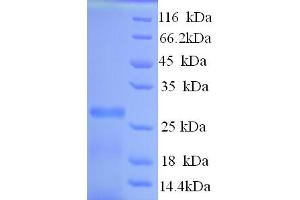 SDS-PAGE (SDS) image for Potassium Voltage-Gated Channel, Shal-Related Subfamily, Member 1 (Kcnd1) (AA 410-647), (Cytoplasmic Domain), (Cytosolic) protein (His tag) (ABIN5713574) (KCND1 Protein (AA 410-647, Cytoplasmic Domain, Cytosolic) (His tag))