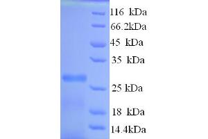 SDS-PAGE (SDS) image for Potassium Voltage-Gated Channel, Shal-Related Subfamily, Member 1 (Kcnd1) (AA 410-647), (Cytoplasmic Domain), (Cytosolic) protein (His tag) (ABIN5713574)