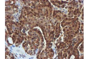 Image no. 5 for anti-F-Box Protein 21 (FBXO21) antibody (ABIN1498235)