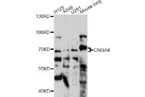 Western blot analysis of extracts of various cell lines, using CNGA4 antibody (ABIN6291314) at 1:1000 dilution.