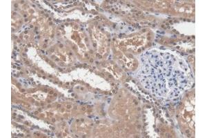 DAB staining on IHC-P; Samples: Human Kidney Tissue (DICER1 Antikörper  (AA 6-290))
