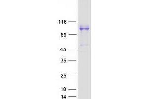 Western Blotting (WB) image for Membrane Metallo-Endopeptidase (MME) (Transcript Variant 1) protein (Myc-DYKDDDDK Tag) (ABIN2713344)