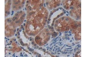 Detection of Cys-C in Human Kidney Tissue using Polyclonal Antibody to Cystatin C (Cys-C) (Cystathionine-gamma-Synthase Precursor (CYS) (AA 27-146) Antikörper)