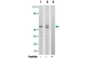 Western blot analysis of extracts from 293 cells (Lane 1) and mouse liver cells (Lane 2 and lane 3), using ACVR1B polyclonal antibody . (Activin A Receptor Type IB/ALK-4 Antikörper  (AA 73-122))