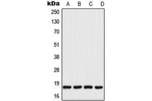 Western blot analysis of UBC9 expression in HeLa (A), A431 (B), Raw264. (UBE2I Antikörper  (C-Term))