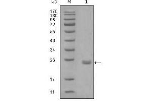 Western Blot showing AXL antibody used against truncated Trx-AXL recombinant protein (1).