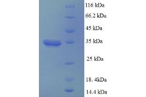 SDS-PAGE (SDS) image for Dynactin 3 (p22) (Dctn3) (AA 2-176) protein (His-SUMO Tag) (ABIN4974293) (DCTN3 Protein (AA 2-176) (His-SUMO Tag))