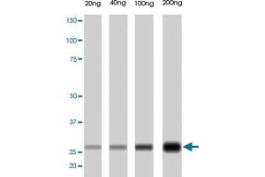 PRSS1 monoclonal antibody, clone A16-N  . (PRSS1 Antikörper  (N-Term))