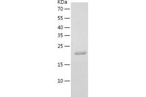 Western Blotting (WB) image for YKT6 V-SNARE Homolog (YKT6) (AA 1-198) protein (His tag) (ABIN7125758) (YKT6 Protein (AA 1-198) (His tag))