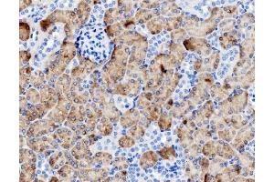 IHC analysis of PCK1/PEPC using anti-PCK1/PEPC antibody (ABIN7599502). (PCK1 Antikörper  (AA 1-622))