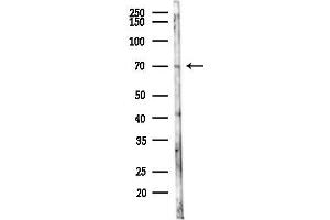 Western blot analysis of lysates from Mouse lung, using C Antibody at 1/1000 dilution.